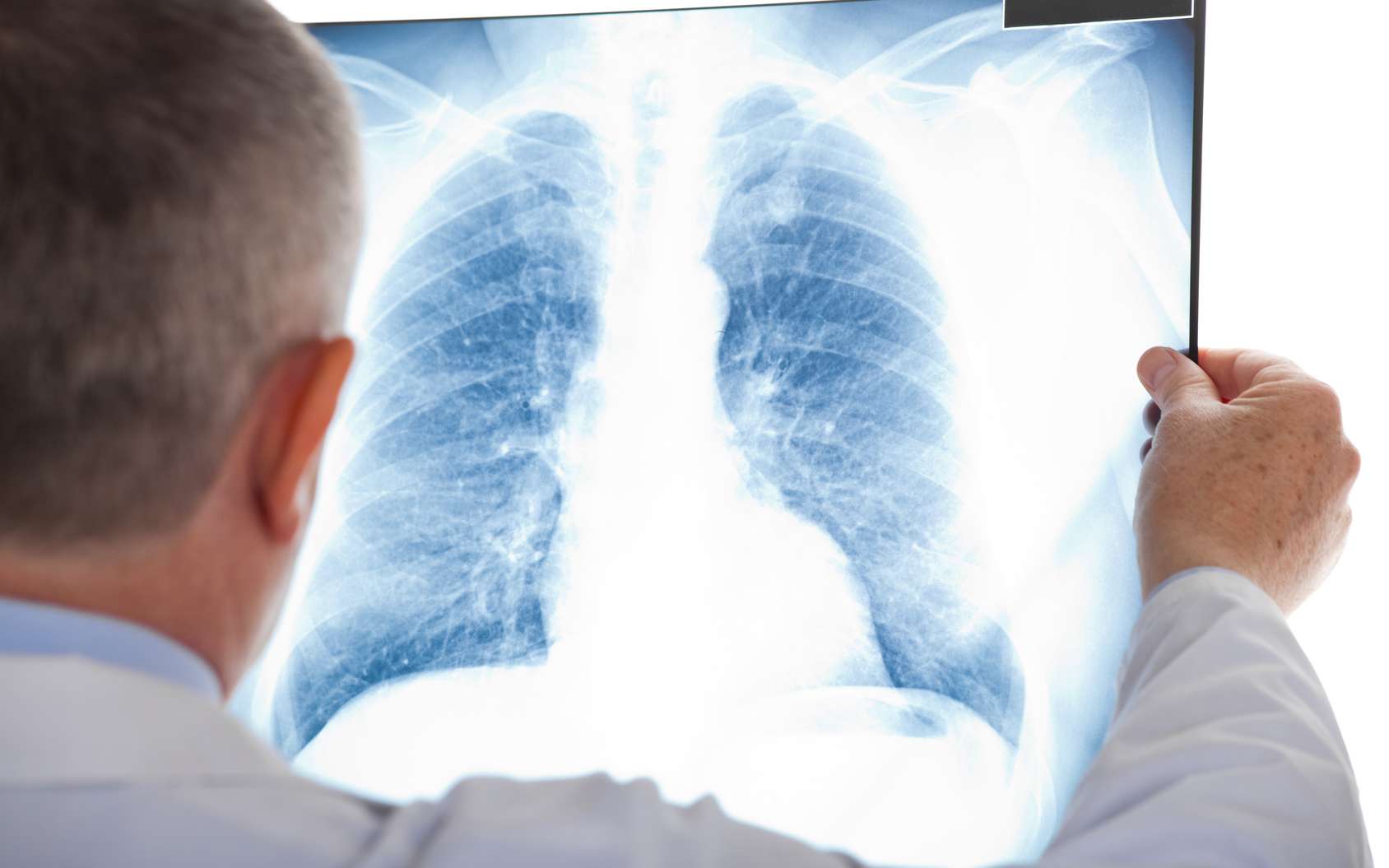 Radiographie par Rayon X Une radiographie de torse observé par un médecin